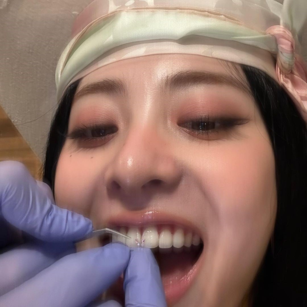 Huh Yunjin 